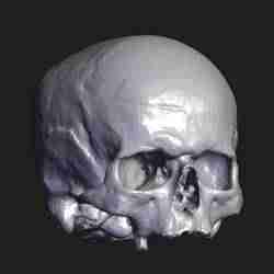 human skull