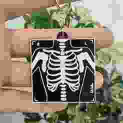 Radiology Key Ring - Chest X-Ray