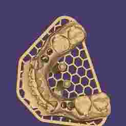 3D Model of Implant-Supported Arches - 8 Elements (Upper and Lower)