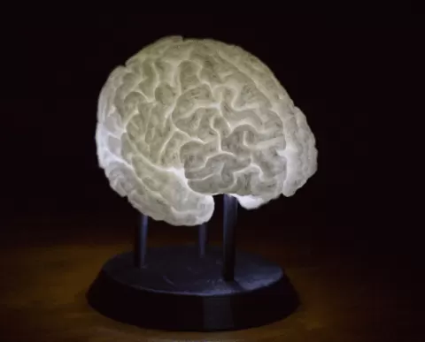 Brain with ALS