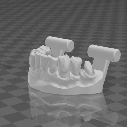 High-Quality Dental Model lower arch – Ideal for Study & Practice