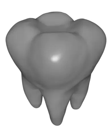 Missing Tooth