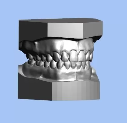 Parallel, ABO, Tweed, Ricketts, ABO 2013 Study Models
