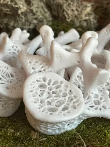 Voronoi Vertebrae (lumbar)