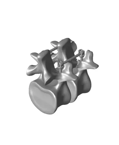 pedicle pars construct.stl