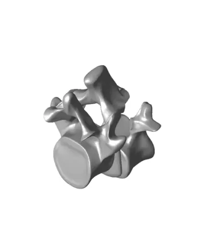 Spondy grade 2 listhesis bennett model.stl