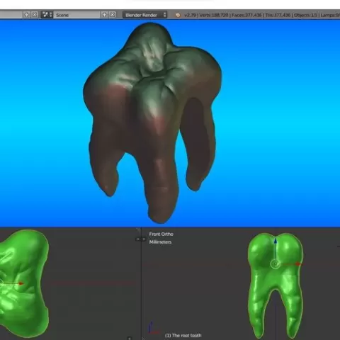 The root tooth