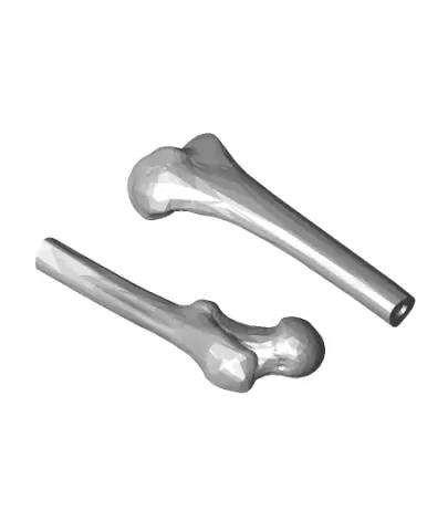 femoral anteversion model