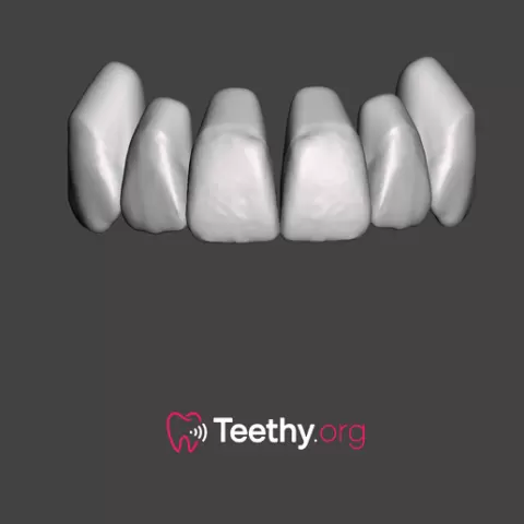 Anterior Teeth