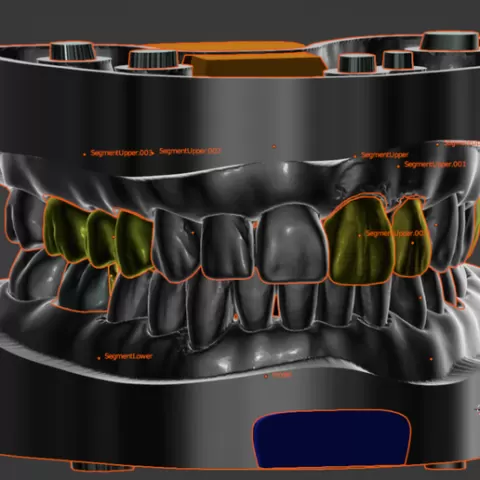 Working model for designing crowns