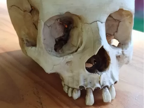 Skull with separate teeth