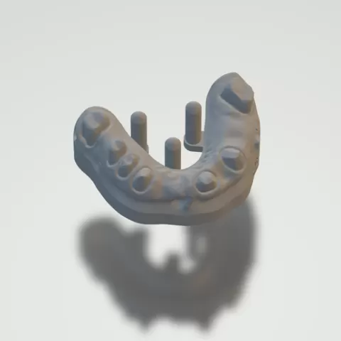 Dental project complete