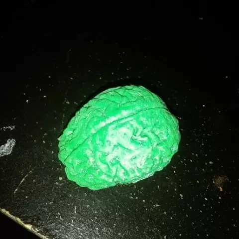 my brain