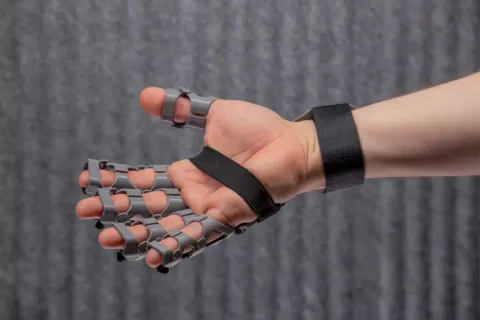 Improving fine motor skills, designing a 3D FDM printed orthosis to assist in the rehabilitation of individuals with hand spasticity