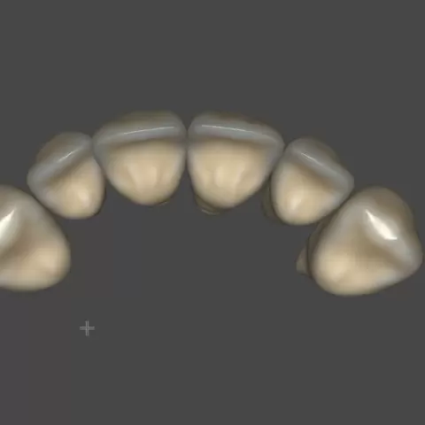 Anatomic exocad Library #4