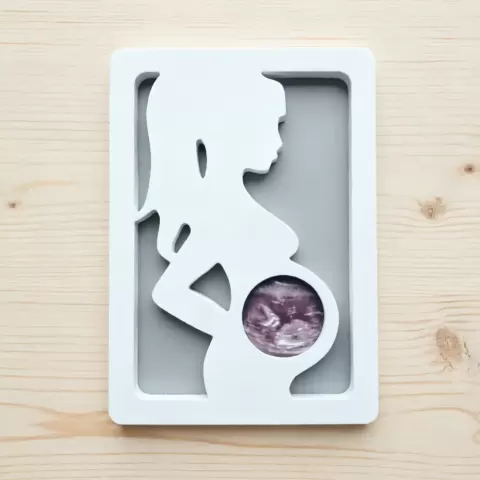 A frame for a photo of an ultrasound of a baby
