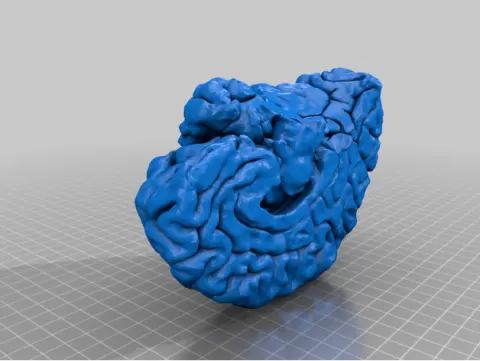 Neuroanatomy / Brain / Cortex