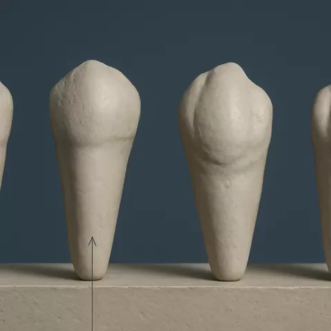Upper Canine and Upper Premolar