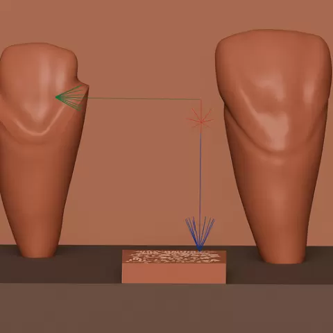 Lateral