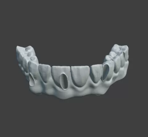 Prótese Dentária AC3