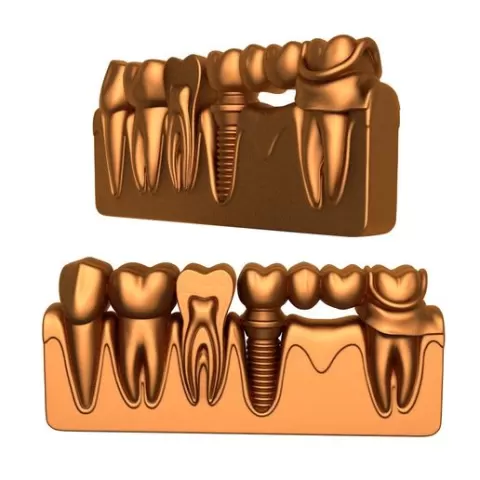 dental implant / dental implant stl / implant printer / Teeth Dental Implants / Tooth / Tooth stl