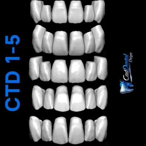 CTD1-5 Exocad libraries