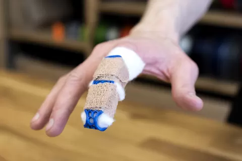 Finger Brace (splint)