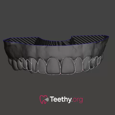 Dental proportion guidelines for meshmixer