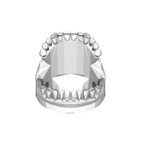 ring1