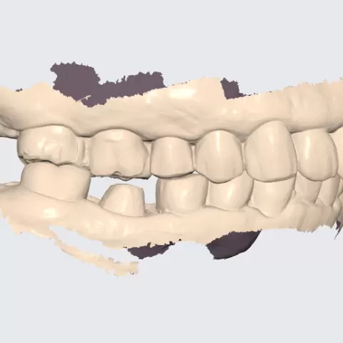Prep Tooth Model (46)