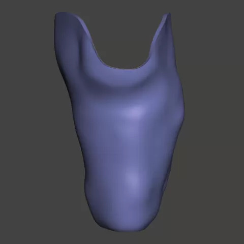 Below Knee Prosthetic Socket
