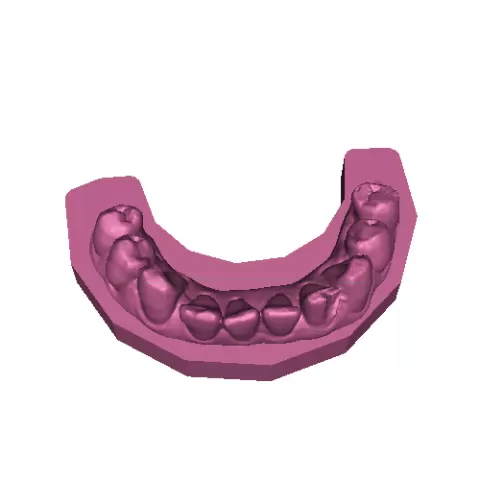 model cast
