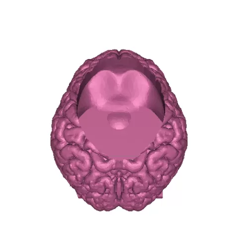 Brain bowl