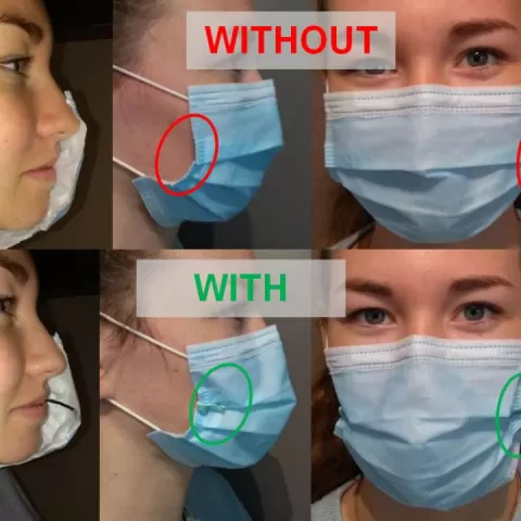 Surgical mask retractor COVID19/ Ecarteur de masque chirurgical by ALTYLAB ALTYGO by ALTYLAB